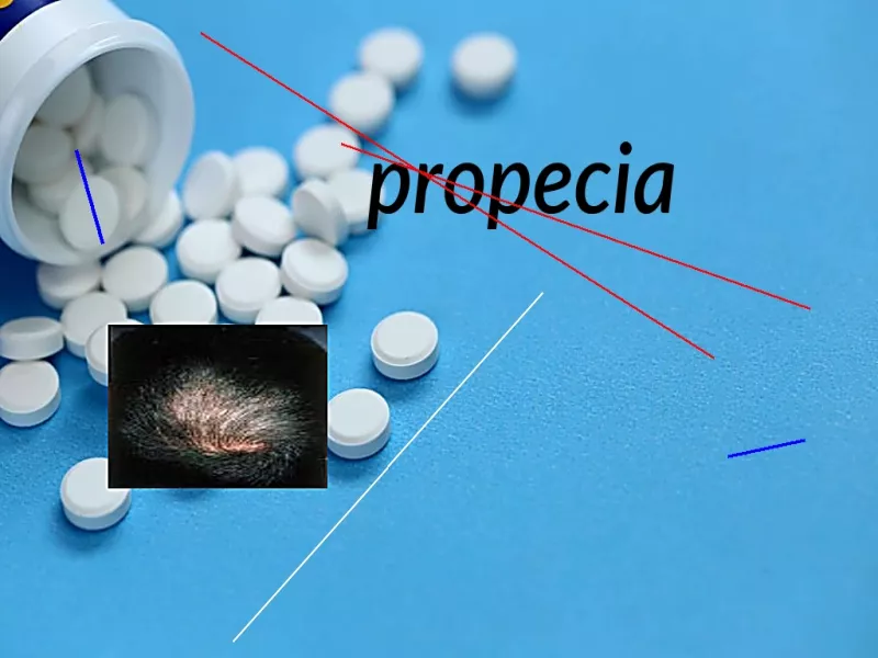 Propecia